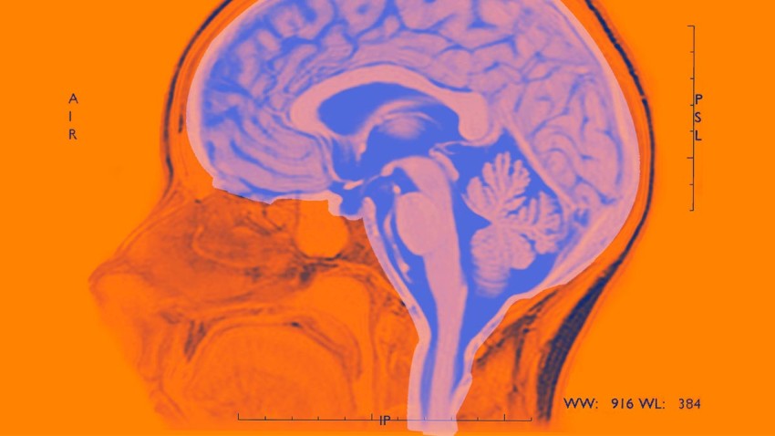 Fig no 2. Brain Scan. Source: Harvard Business Review